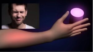 Abnormal co-contraction of agonist and anatagonist muscles in CRPS 1