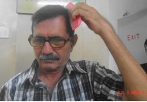 The patient after 20 days of treatment 1