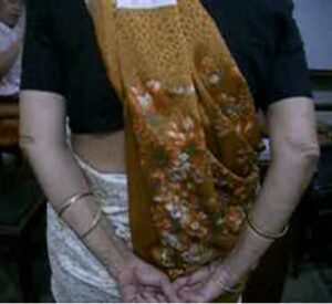 lady with shoulder hand syndrome and the man with Colle’s fracture of wrist 2