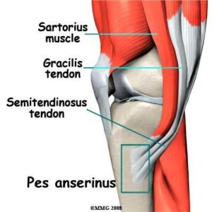 Patterns Seen in Osteoarthritis